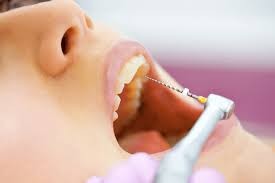 Root Canal Treatment